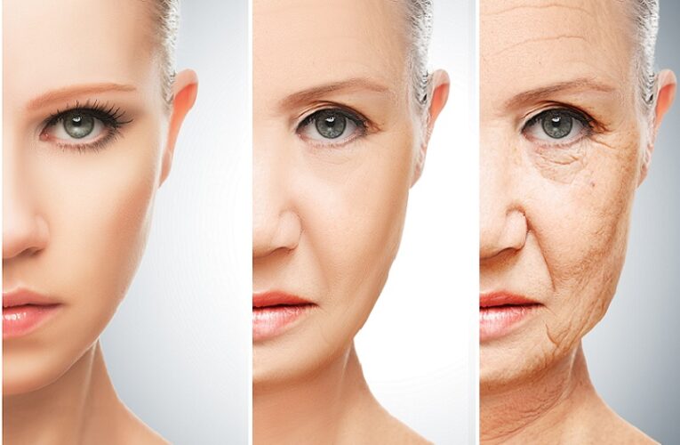 What Causes Wrinkles Apart from Aging?